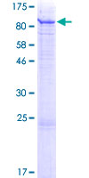 ab162261 on a 12.5% SDS-PAGE stained with Coomassie Blue.