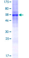 ab165757 on a 12.5% SDS-PAGE stained with Coomassie Blue.