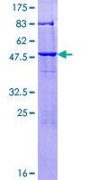 ab163964 on a 12.5% SDS-PAGE stained with Coomassie Blue.