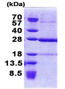 3 µg ab168069 on 15% SDS-PAGE