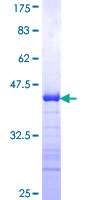 ab163965 on a 12.5% SDS-PAGE stained with Coomassie Blue.
