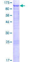ab163191 on a 12.5% SDS-PAGE stained with Coomassie Blue.