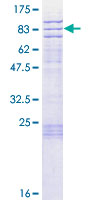 ab164466 on a 12.5% SDS-PAGE stained with Coomassie Blue.