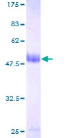 ab163928 on a 12.5% SDS-PAGE stained with Coomassie Blue.