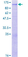 ab164352 on a 12.5% SDS-PAGE stained with Coomassie Blue.