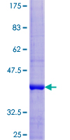 ab166420 on a 12.5% SDS-PAGE stained with Coomassie Blue.