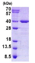 15% SDS-PAGE analysis of 3 µg ab140560.