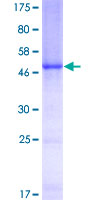 ab157983 on a 12.5% SDS-PAGE stained with Coomassie Blue.