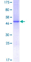 ab157984 on a 12.5% SDS-PAGE stained with Coomassie Blue.
