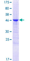 ab161187 on a 12.5% SDS-PAGE stained with Coomassie Blue.