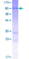 ab165476 on a 12.5% SDS-PAGE stained with Coomassie Blue.