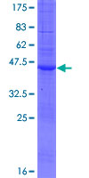ab165304 on a 12.5% SDS-PAGE stained with Coomassie Blue.