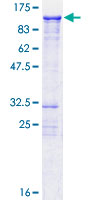 ab163256 on a 12.5% SDS-PAGE stained with Coomassie Blue.