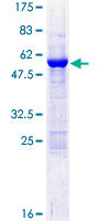 ab159964 on a 12.5% SDS-PAGE stained with Coomassie Blue.