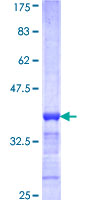 ab159965 on a 12.5% SDS-PAGE stained with Coomassie Blue.