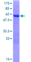 ab163396 on a 12.5% SDS-PAGE stained with Coomassie Blue.