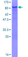 ab164964 on a 12.5% SDS-PAGE stained with Coomassie Blue.