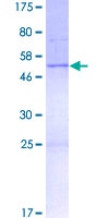 ab164624 on a 12.5% SDS-PAGE stained with Coomassie Blue.
