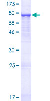 ab162572 on a 12.5% SDS-PAGE stained with Coomassie Blue.