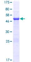 ab166520 on a 12.5% SDS-PAGE stained with Coomassie Blue.