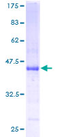 ab162530 on a 12.5% SDS-PAGE stained with Coomassie Blue.