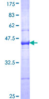 ab157985 on a 12.5% SDS-PAGE stained with Coomassie Blue.