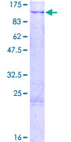 ab164792 on a 12.5% SDS-PAGE stained with Coomassie Blue.
