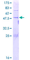 ab165368 on a 12.5% SDS-PAGE stained with Coomassie Blue.