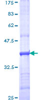 ab157988 on a 12.5% SDS-PAGE stained with Coomassie Blue.