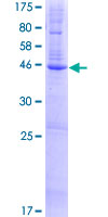 ab161171 on a 12.5% SDS-PAGE stained with Coomassie Blue.