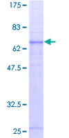 ab157989 on a 12.5% SDS-PAGE stained with Coomassie Blue.
