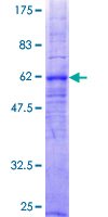 ab157990 on a 12.5% SDS-PAGE stained with Coomassie Blue.