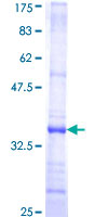 ab157991 on a 12.5% SDS-PAGE stained with Coomassie Blue.