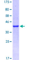 ab166576 on a 12.5% SDS-PAGE stained with Coomassie Blue.
