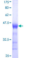 ab161173 on a 12.5% SDS-PAGE stained with Coomassie Blue.