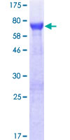 ab162467 on a 12.5% SDS-PAGE stained with Coomassie Blue.