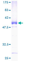 ab163931 on a 12.5% SDS-PAGE stained with Coomassie Blue.