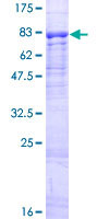 ab165691 on a 12.5% SDS-PAGE stained with Coomassie Blue.