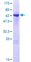 12.5% SDS-PAGE analysis of ab132789 stained with Coomassie Blue.