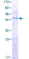 ab165419 on a 12.5% SDS-PAGE stained with Coomassie Blue.