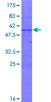 ab166503 on a 12.5% SDS-PAGE stained with Coomassie Blue.