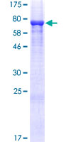 ab162586 on a 12.5% SDS-PAGE stained with Coomassie Blue.