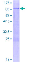 ab166076 on a 12.5% SDS-PAGE stained with Coomassie Blue.