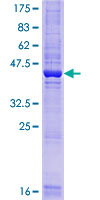 ab161291 on a 12.5% SDS-PAGE stained with Coomassie Blue.
