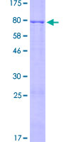 ab165808 on a 12.5% SDS-PAGE stained with Coomassie Blue.