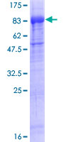 ab165809 on a 12.5% SDS-PAGE stained with Coomassie Blue.