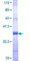 ab165810 on a 12.5% SDS-PAGE stained with Coomassie Blue.