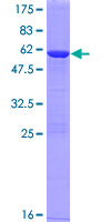 ab166389 on a 12.5% SDS-PAGE stained with Coomassie Blue.