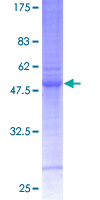 ab158010 on a 12.5% SDS-PAGE stained with Coomassie Blue.