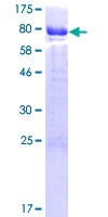 ab164756 on a 12.5% SDS-PAGE stained with Coomassie Blue.